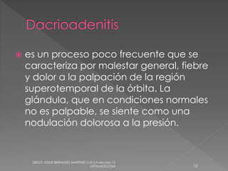 es un proceso poco frecuente que se 
caracteriza por malestar general, fiebre 
y dolor a la palpación de la región 
superotemporal de la órbita. La 
glándula, que en condiciones normales 
no es palpable, se siente como una 
nodulación dolorosa a la presión. 
DIEGO JOSUE BERMUDEZ MARTINEZ U.M.S.H seccion 12 
OFTALMOLOGIA 12 
 