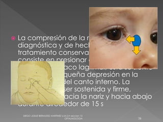  La compresión de la región del saco es 
diagnóstica y de hecho constituye un 
tratamiento conservador. Esta maniobra 
consiste en presionar con el dedo índice 
la región del saco lagrimal; ésta se siente 
como una pequeña depresión en la 
parte inferior del canto interno. La 
presión debe ser sostenida y firme, 
aplicándola hacia la nariz y hacia abajo 
durante alrededor de 15 s 
DIEGO JOSUE BERMUDEZ MARTINEZ U.M.S.H seccion 12 
OFTALMOLOGIA 26 
 