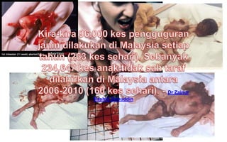 Dr Zainur
Rashid Zainuddin

 