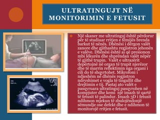 ULTRATINGUJT NË
MONITORIMIN E FETUSIT
 Një skaner me ultratinguj është përdorur
për të studiuar rritjen e fëmijës brenda
barkut të nënës. Dhënësi i dërgon valët
zanore dhe gjithashtu regjistron jehonën
e valëve. Dhënësi është ai që presionon
mbi lëkurën dhe shprëndan valët nëpër
të gjithë trupin. Valët e ultrazërit
depërtojnë në organ të trupit njerëzor
dhe të marrin reflektimin nga organi i
cili do të shqyrtohet. Mikrofoni i
ndjeshëm në dhënës regjistron
ndryshimet e vogla të tingullit dhe
drejtimin e tij. Pastaj ato valët e
pasqyruara ultratinguj pasqyrohen në
kompjuter dhe kemi një imazh të qartë
të fetusit të palindur. Imazh 3D i fetusit
ndihmon mjekun të zbulojëndonjë
sëmundje ose defekt dhe e ndihmon të
monitorojë rritjen e fetusit.
 