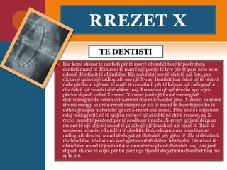 RREZET X
TE DENTISTI
 Kur kemi shkuar te dentisti për të marrë dhëmbët tanë të pastrohen,
dentisti mund të dëshironi të marrë një pamje të tyre për të parë nëse kemi
ndonjë dëmtimit të dhëmbëve. Kjo nuk është me të vërtetë një foto, por
diçka që quhet një radiografi, ose një X-ray. Dentisti juaj është në të vërtetë
duke përdorur një sasi të vogël të rrezatimit për të krijuar një radiografi e
cila është një imazh i dhëmbëve tuaj. Rrezatimi që një dentist apo mjek
përdor shpesh quhet X-rrezet. X-rrezet janë një formë e energjisë
elektromagnetike vetëm drita-rrezet dhe mikro-valët janë. X-rrezet kanë më
shumë energji se drita-rrezet mënyrë që ata të mund të depërtojnë dhe të
udhëtojë nëpër materialet që drita-rrezet nuk mund. Film është i ndjeshëm
ndaj radiografitë në të njëjtën mënyrë që ai është në dritë-rrezeve, aq X-
rrezet mund të përdoret për të prodhuar imazhe. X-rrezet që janë dërguar
me anë të një objekti mund të prodhojë një imazh në një pjesë të filmit të
vendosur në anën e kundërt të objektit. Duke ekzaminuar imazhin ose
radiografi, dentisti mund të shqyrtojë dhëmbët për gjëra të tilla si dëmtimit
të dhëmbëve, të cilat nuk janë gjithmonë të shihen lehtësisht. Dëmtimit të
dhëmbëve mund të jenë defekte shumë të vogla në dhëmbët tuaj. Ata janë
shpesh shumë të vogla për t'u parë nga thjesht shqyrtimin dhëmbët tuaj me
sy të lirë.
 