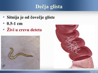 Dečja glista
Sitnija je od čovečje gliste
0.5-1 cm
Živi u crevu deteta
 