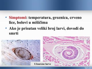 Simptomi: temperatura, groznica, crveno
lice, bolovi u mišičima
Ako je prisutan veliki broj larvi, dovodi do
smrti
Učaurene larve
 