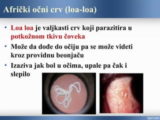 Afrički očni crv (loa-loa)
Loa loa je valjkasti crv koji parazitira u
potkožnom tkivu čoveka
Može da dođe do očiju pa se može videti
kroz providnu beonjaču
Izaziva jak bol u očima, upale pa čak i
slepilo
 