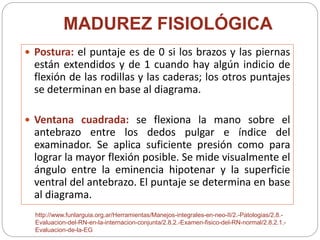 MADUREZ FISIOLÓGICA 
 Postura: el puntaje es de 0 si los brazos y las piernas 
están extendidos y de 1 cuando hay algún indicio de 
flexión de las rodillas y las caderas; los otros puntajes 
se determinan en base al diagrama. 
 Ventana cuadrada: se flexiona la mano sobre el 
antebrazo entre los dedos pulgar e índice del 
examinador. Se aplica suficiente presión como para 
lograr la mayor flexión posible. Se mide visualmente el 
ángulo entre la eminencia hipotenar y la superficie 
ventral del antebrazo. El puntaje se determina en base 
al diagrama. 
http://www.funlarguia.org.ar/Herramientas/Manejos-integrales-en-neo-II/2.-Patologias/2.8.- 
Evaluacion-del-RN-en-la-internacion-conjunta/2.8.2.-Examen-fisico-del-RN-normal/2.8.2.1.- 
Evaluacion-de-la-EG 
 
