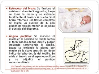  Retroceso del brazo: Se flexiona el 
antebrazo durante 5 segundos; luego 
se toma la mano y se extiende 
totalmente el brazo y se suelta. Si el 
brazo retorna a una flexión completa 
se asigna un puntaje de 4. Con 
grados de flexión menor se adjudica 
el puntaje del diagrama. 
 Ángulo poplíteo: Se sostiene el 
muslo en la posición de rodilla contra 
el tórax con los dedos índice y pulgar 
izquierdo sosteniendo la rodilla. 
Luego se extiende la pierna por 
medio de la suave presión del dedo 
índice derecho detrás del tobillo. Se 
mide el ángulo en el espacio poplíteo 
y se adjudica el puntaje 
correspondiente. 
http://www.funlarguia.org.ar/Herramientas/Manejos-integrales-en-neo-II/2.-Patologias/2.8.- 
Evaluacion-del-RN-en-la-internacion-conjunta/2.8.2.-Examen-fisico-del-RN-normal/2.8.2.1.- 
Evaluacion-de-la-EG 
 