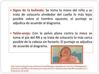  Signo de la bufanda: Se toma la mano del niño y se 
trata de colocarla alrededor del cuello lo más lejos 
posible sobre el hombro opuesto; el puntaje se 
adjudica de acuerdo al diagrama. 
 Talón-oreja: Con la pelvis plana contra la mesa se 
toma el pie del RN y se trata de colocarlo lo más cerca 
posible de la cabeza sin forzarlo. El puntaje se adjudica 
de acuerdo al diagrama. 
http://www.funlarguia.org.ar/Herramientas/Manejos-integrales-en-neo-II/2.-Patologias/2.8.- 
Evaluacion-del-RN-en-la-internacion-conjunta/2.8.2.-Examen-fisico-del-RN-normal/2.8.2.1.- 
Evaluacion-de-la-EG 
 