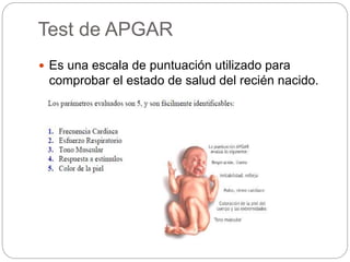 Test de APGAR 
 Es una escala de puntuación utilizado para 
comprobar el estado de salud del recién nacido. 
 