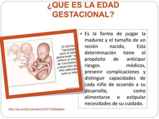 ¿QUE ES LA EDAD 
GESTACIONAL? 
 Es la forma de juzgar la 
madurez y el tamaño de un 
recién nacido, Esta 
determinación tiene el 
propósito de anticipar 
riesgos médicos, 
prevenir complicaciones y 
distinguir capacidades de 
cada niño de acuerdo a su 
desarrollo, como 
alimentarse o estipular 
necesidades de su cuidado. 
http://es.scribd.com/doc/2197124/Ballard 
 