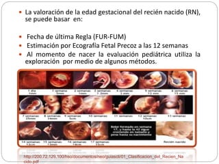  La valoración de la edad gestacional del recién nacido (RN), 
se puede basar en: 
 Fecha de última Regla (FUR-FUM) 
 Estimación por Ecografía Fetal Precoz a las 12 semanas 
 Al momento de nacer la evaluación pediátrica utiliza la 
exploración por medio de algunos métodos. 
http://200.72.129.100/hso/documentos/neo/guiascli/01_Clasificacion_del_Recien_Na 
cido.pdf 
 