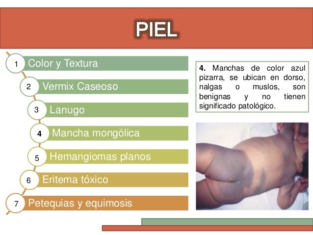 Eritema toxico recien nacido pdf creator
