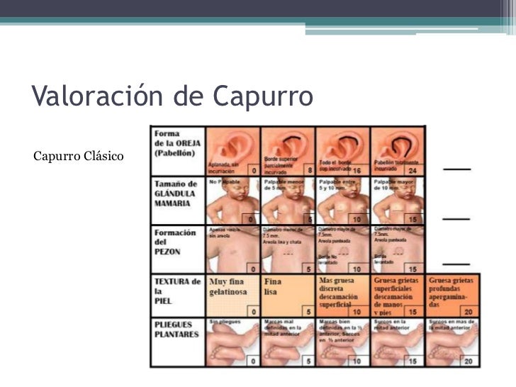 Test De Capurro En El Recien Nacido Pdf