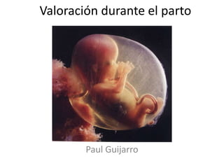 Valoración durante el parto
Paul Guijarro
 