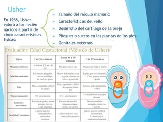 Usher
En 1966, Usher
valoró a los recién
nacidos a partir de
cinco características
físicas:
 Tamaño del nódulo mamario
 Características del vello
 Desarrollo del cartílago de la oreja
 Pliegues o surcos en las plantas de los pies
 Genitales externos
 
