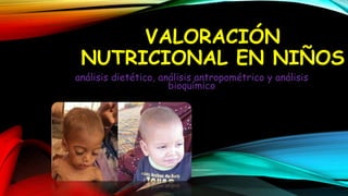 VALORACIÓN
NUTRICIONAL EN NIÑOS
análisis dietético, análisis antropométrico y análisis
bioquímico
 