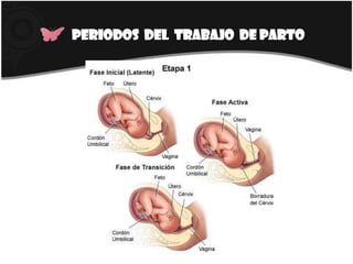 Periodos  del  trabajo  de parto 