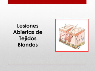 Sangre puede escaparse de los vasos lesionados y acumularse en el tejidoHematomaDaño a vasos mayoresGran cantidad de tejido está involucradoMasa grande con coloración azulLa sangre se colecta bajo la piel