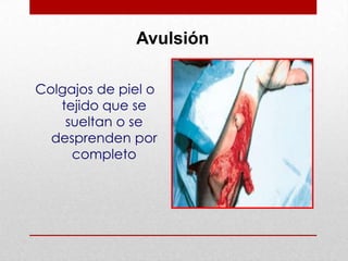 Lesiones Abiertas de Tejidos Blandos