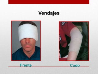 Controlar el sangrado