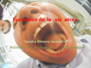 Evaluación de  la   vía  aérea Sandra Ximena Jaramillo R. Residente  de  anestesiología   y  Reanimación 