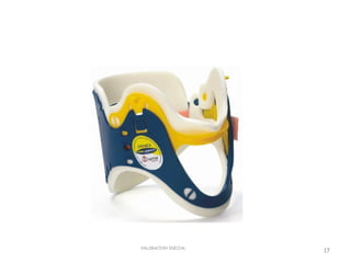 VALORACION INICIAL
                     17
 