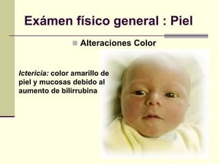 Exámen físico general : Piel
 Alteraciones Color
Ictericia: color amarillo de
piel y mucosas debido al
aumento de bilirrubina
 