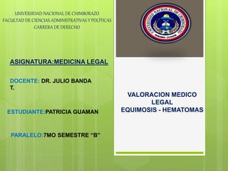 VALORACION MEDICO
LEGAL
EQUIMOSIS - HEMATOMAS
UNIVERSIDAD NACIONAL DE CHIMBORAZO
FACULTAD DE CIENCIAS ADMINISTRATIVAS Y POLÍTICAS
CARRERA DE DERECHO
ASIGNATURA:MEDICINA LEGAL
DOCENTE: DR. JULIO BANDA
T.
ESTUDIANTE:PATRICIA GUAMAN
PARALELO:7MO SEMESTRE “B”
 