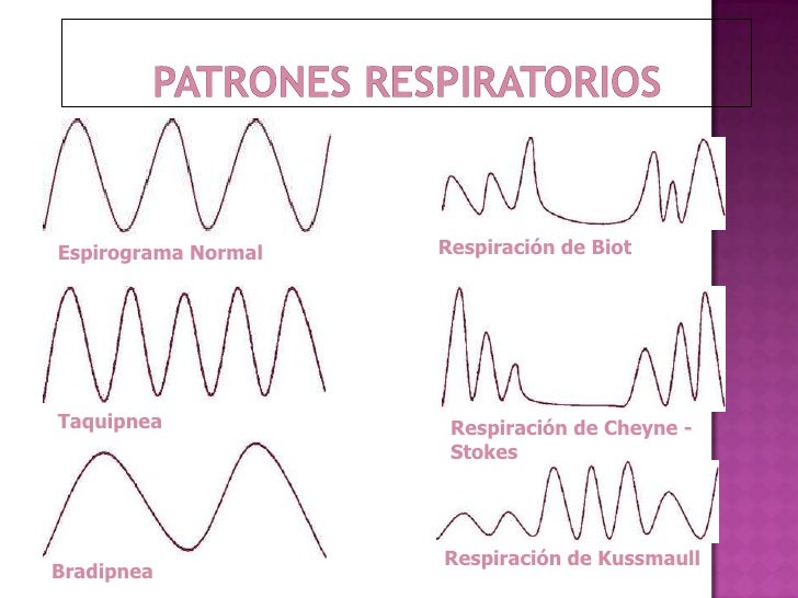Valoracion neurologica en uci