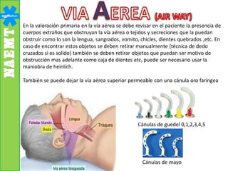 En la valoración primaria en la vía aérea se debe revisar en el paciente la presencia de
cuerpos extraños que obstruyan la vía aérea o tejidos y secreciones que la puedan
obstruir como lo son la lengua, sangrados, vomito, chicles, dientes quebrados ,etc. En
caso de encontrar estos objetos se deben retirar manualmente (técnica de dedo
cruzados si es solido) también se deben retirar objetos que puedan ser motivo de
obstrucción mas adelante como caja de dientes etc, puede ser necesario usar la
maniobra de heinlich.
También se puede dejar la vía aérea superior permeable con una cánula oro faríngea
Cánulas de guedel 0,1,2,3,4,5
Cánulas de mayo
 