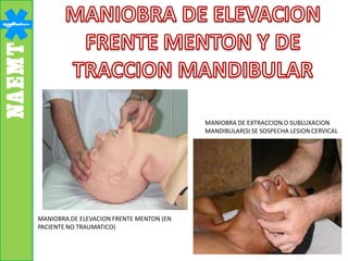 MANIOBRA DE ELEVACION FRENTE MENTON (EN
PACIENTE NO TRAUMATICO)
MANIOBRA DE EXTRACCION O SUBLUXACION
MANDIBULAR(SI SE SOSPECHA LESION CERVICAL
 