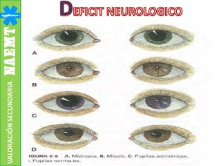 VALORACIÓNSECUNDARIA
 