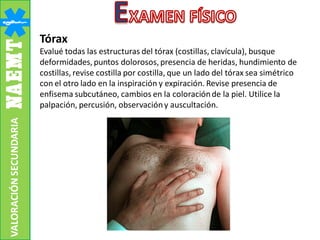 Tórax
Evalué todas las estructuras del tórax (costillas, clavícula), busque
deformidades,puntos dolorosos,presencia de heridas, hundimiento de
costillas, revise costilla por costilla, que un lado del tórax sea simétrico
con el otro lado en la inspiración y expiración. Revise presencia de
enfisema subcutáneo, cambios en la coloraciónde la piel. Utilice la
palpación, percusión, observacióny auscultación.
VALORACIÓNSECUNDARIA
 