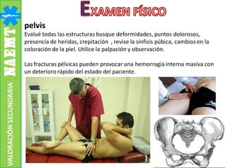 pelvis
Evalué todas las estructuras busque deformidades, puntos dolorosos,
presencia de heridas, crepitación , revise la sínfisis púbica, cambios en la
coloración de la piel. Utilice la palpación y observación.
Las fracturas pélvicas pueden provocar una hemorragia interna masiva con
un deterioro rápido del estado del paciente.
VALORACIÓNSECUNDARIA
 