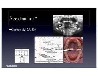 Âge dentaire 7
lGarçon

©Dr Sylvain Chamberland,
sylvainchamberland.com

de 7A 4M

 