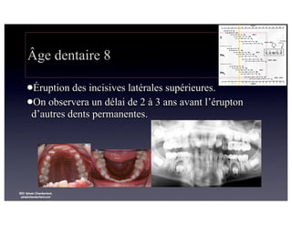 Âge dentaire 8
lÉruption

des incisives latérales supérieures.
lOn observera un délai de 2 à 3 ans avant l’érupton
d’autres dents permanentes.

©Dr Sylvain Chamberland,
sylvainchamberland.com

 
