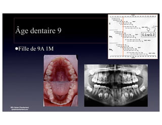 Âge dentaire 9
lFille

©Dr Sylvain Chamberland,
sylvainchamberland.com

de 9A 1M

 