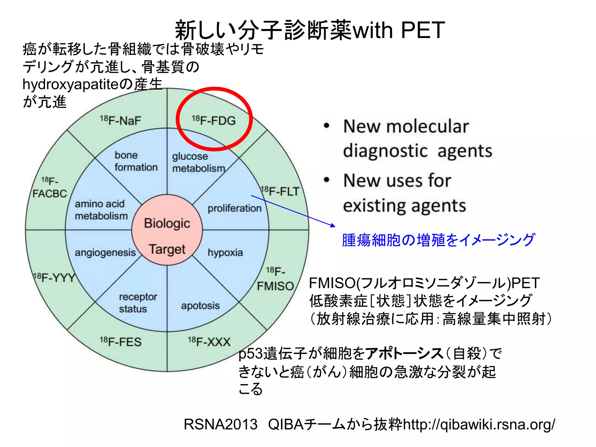 新しい分子診断薬with PET
RSNA2013 QIBAチームから抜粋http://qibawiki.rsna.org/
腫瘍細胞の増殖をイメージング
FMISO(フルオロミソニダゾール)PET
低酸素症［状態］状態をイメージング
（放射線治療に応用：高線量集中照射）
p53遺伝子が細胞をアポトーシス（自殺）で
きないと癌（がん）細胞の急激な分裂が起
こる
癌が転移した骨組織では骨破壊やリモ
デリングが亢進し、骨基質の
hydroxyapatiteの産生
が亢進
 