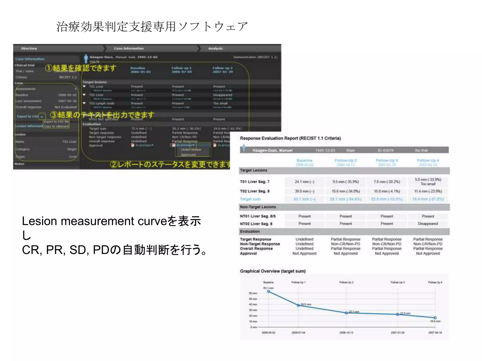 治療効果判定支援専用ソフトウェア
Lesion measurement curveを表示
し
CR, PR, SD, PDの自動判断を行う。
 