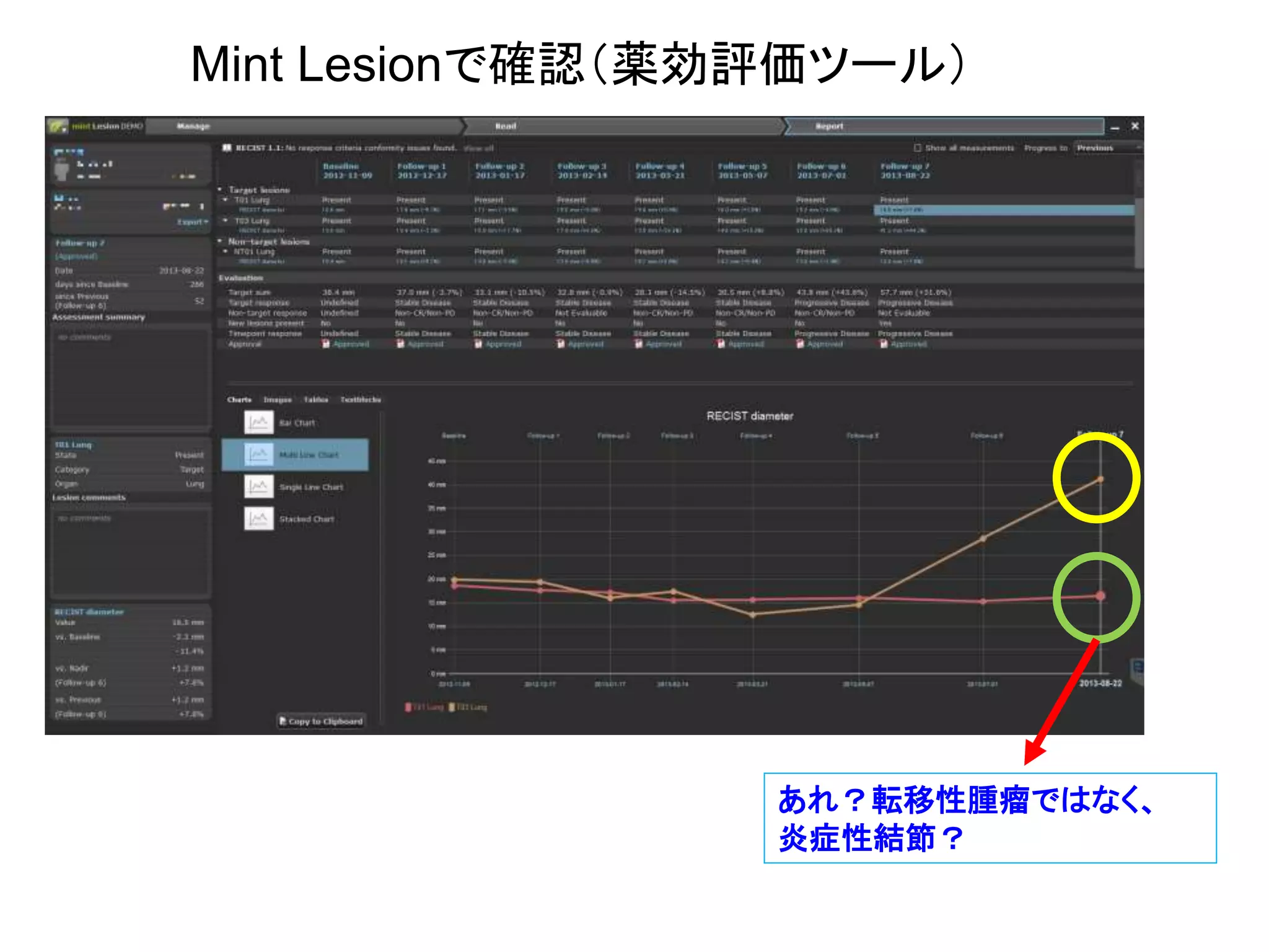 Mint Lesionで確認（薬効評価ツール）
あれ？転移性腫瘤ではなく、
炎症性結節？
 