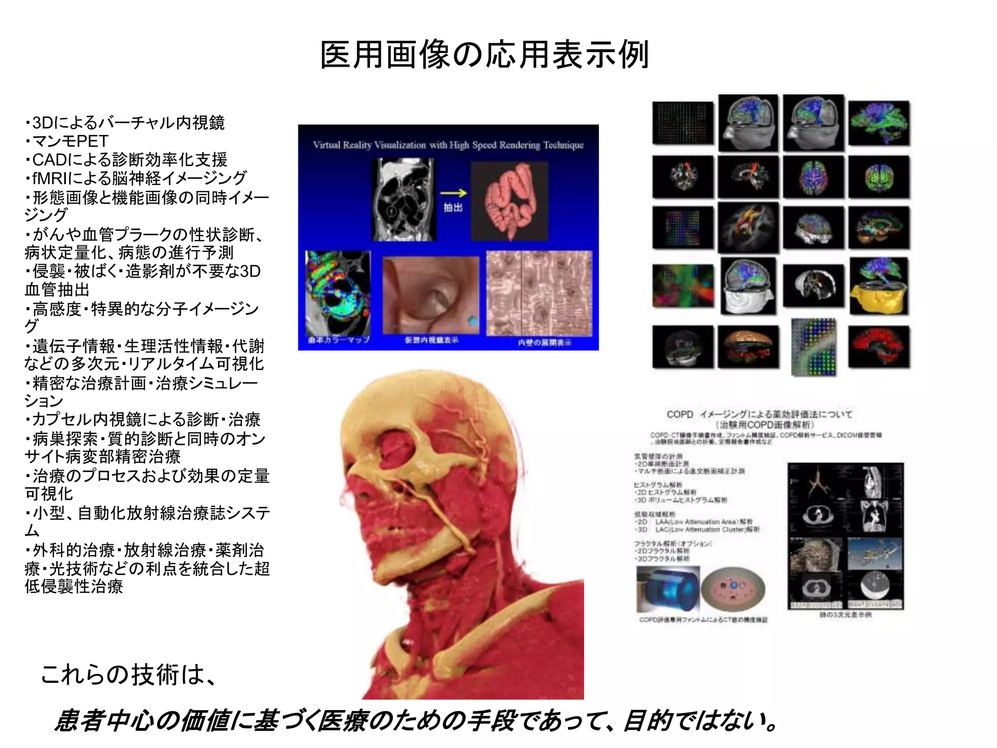 医用画像の応用表示例
・3Dによるバーチャル内視鏡
・マンモPET
・CADによる診断効率化支援
・fMRIによる脳神経イメージング
・形態画像と機能画像の同時イメー
ジング
・がんや血管プラークの性状診断、
病状定量化、病態の進行予測
・侵襲・被ばく・造影剤が不要な3D
血管抽出
・高感度・特異的な分子イメージン
グ
・遺伝子情報・生理活性情報・代謝
などの多次元・リアルタイム可視化
・精密な治療計画・治療シミュレー
ション
・カプセル内視鏡による診断・治療
・病巣探索・質的診断と同時のオン
サイト病変部精密治療
・治療のプロセスおよび効果の定量
可視化
・小型、自動化放射線治療誌システ
ム
・外科的治療・放射線治療・薬剤治
療・光技術などの利点を統合した超
低侵襲性治療
患者中心の価値に基づく医療のための手段であって、目的ではない。
これらの技術は、
 