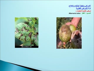 :‫والعلح‬ ‫الوقايه‬ ‫وكيفية‬ ‫ألمراض‬
:‫أول‬‫الفطرية‬ ‫المراض‬
‫المبكرة‬ ‫الندوة‬ ‫مرض‬:
‫المسبب‬:‫الفطر‬Alternaria solan
 