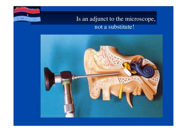 Value Of Ear Endoscopy In Cholesteatoma Surgery.Ppt