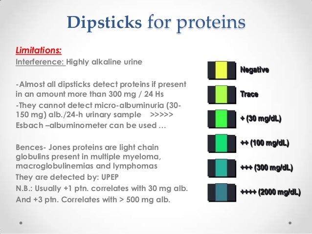 mechanism test strip pregnancy medicine urinalysis of in clinical copy Value mechanism test strip pregnancy medicine urinalysis of in clinical copy Value