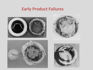 Early Product Failures 