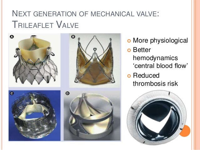 prosthetic valve replacement