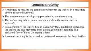 commissurotomy
 Repair may be made to the commissures between the leaflets in a procedure
known as commissurotomy
 The most common valvuloplasty procedure is commissurotomy.
 The leaflets may adhere to one another and close the commissure (ie,
stenosis).
 Less commonly, the leaflets fuse in such a way that, in addition to stenosis,
the leaflets are also prevented from closing completely, resulting in a
backward flow of blood (ie, regurgitation).
 A commissurotomy is the procedure performed to separate the fused leaflets.
 