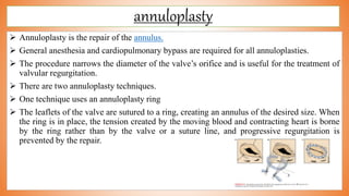annuloplasty
 Annuloplasty is the repair of the annulus.
 General anesthesia and cardiopulmonary bypass are required for all annuloplasties.
 The procedure narrows the diameter of the valve’s orifice and is useful for the treatment of
valvular regurgitation.
 There are two annuloplasty techniques.
 One technique uses an annuloplasty ring
 The leaflets of the valve are sutured to a ring, creating an annulus of the desired size. When
the ring is in place, the tension created by the moving blood and contracting heart is borne
by the ring rather than by the valve or a suture line, and progressive regurgitation is
prevented by the repair.
 