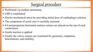Surgical procedure
 Performed via median sternotomy
 CBP is established
 Electro mechanical arrest by providing initial dose of cardioplegic solution
 The component of aortic root is carefully assessed
 4.0 polypropylene horizontal matress sutures are placed on the top of each
commissure.
 Gentle traction is applied
 Finally the valves sutures are examined for geometry, coaptation,
fenestrations, and mobility.
 
