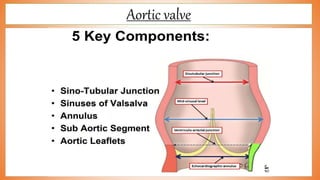 Aortic valve
 