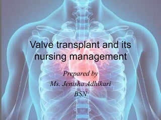 Valve transplant and its
nursing management
Prepared by
Ms. Jenisha Adhikari
BSN
 